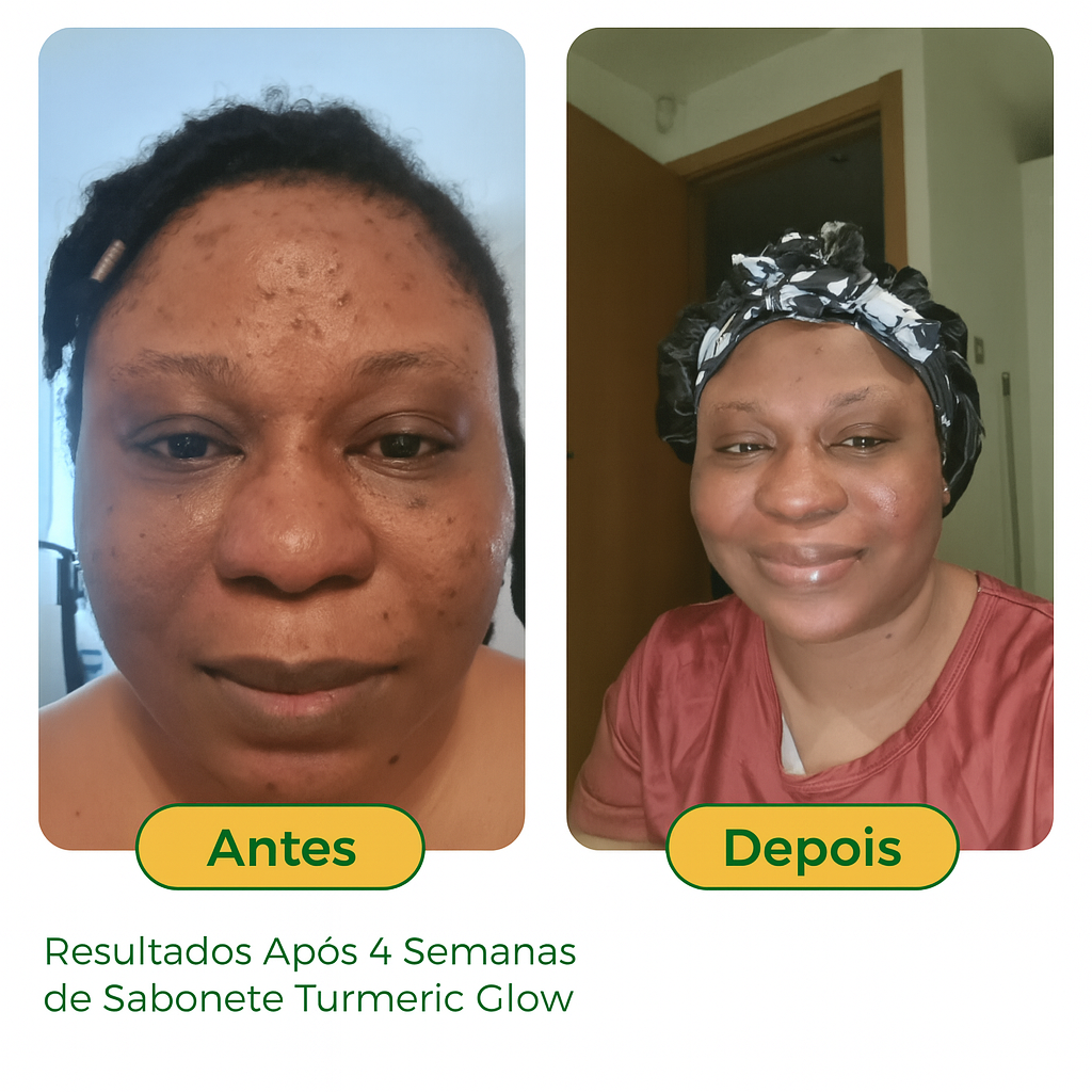 Sabonete de Cúrcuma e Ácido Kójico | Lumena™