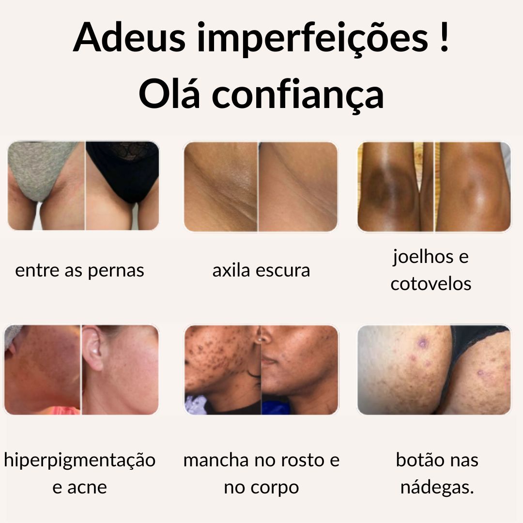 Sabonete de Cúrcuma e Ácido Kójico | Lumena™