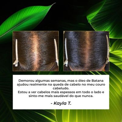 Óleo de Batana Natural | Lumena™